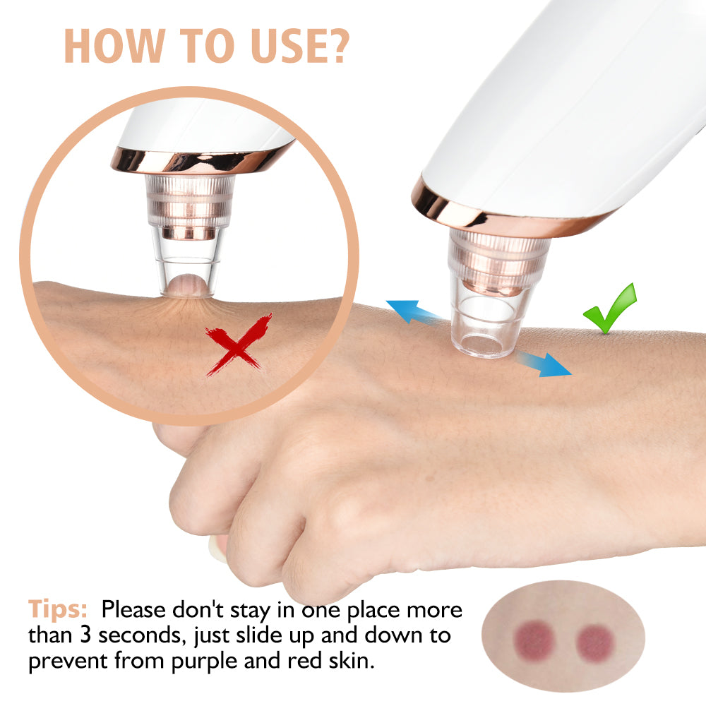 ClearGlow Blackhead Suction Tool