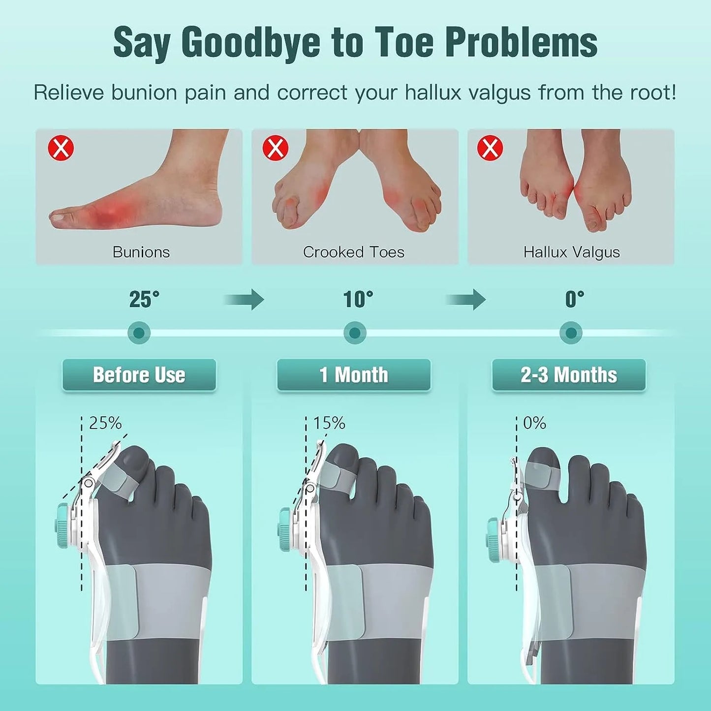 Tech Love Bunion Corrector