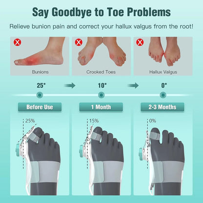 Tech Love Bunion Corrector